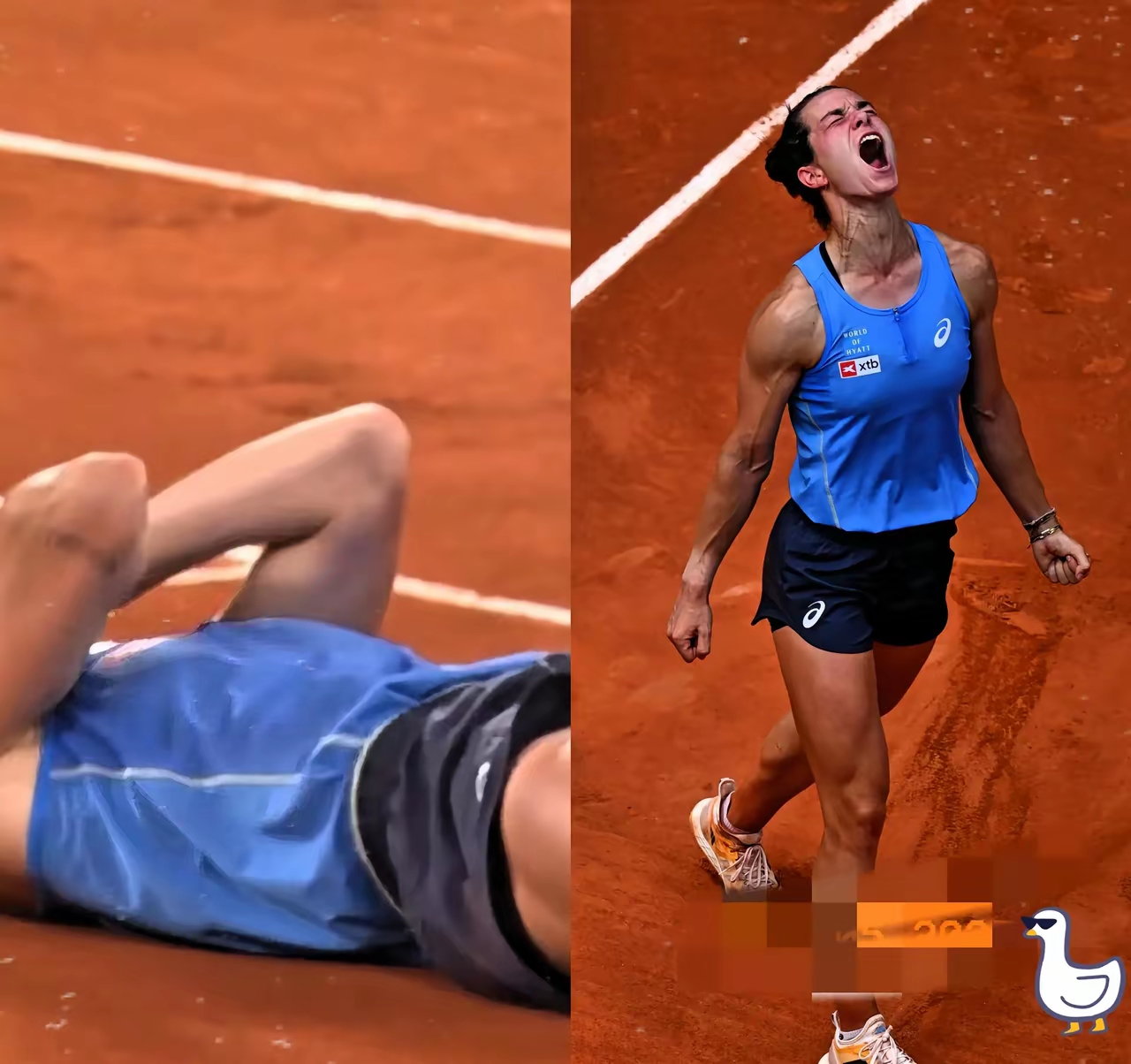 俄罗斯篮球明星受伤退出比赛！